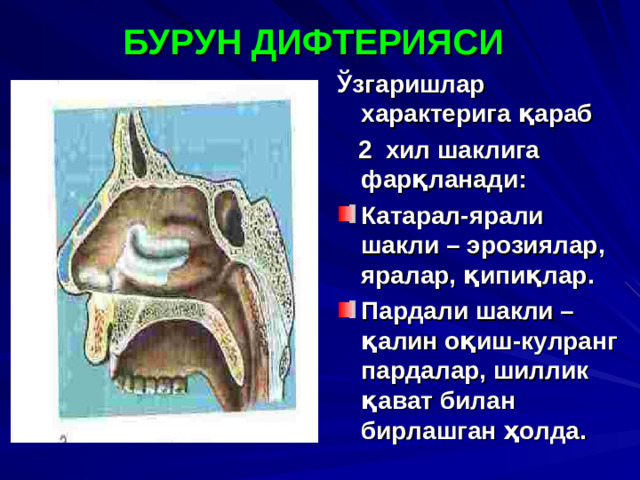 БУРУН ДИФТЕРИЯСИ  Ўзгаришлар характерига қараб  2 хил шаклига фарқланади :