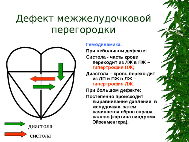 Дефект межжелудочковой перегородки Гемодинамика. При небольшом дефекте: Систола - часть крови переходит из ЛЖ в ПЖ – гипертрофия ПЖ; Диастола – кровь перехо-дит из ЛП и ПЖ в ЛЖ – гипертрофия ЛЖ. При большом дефекте: Постепенно происходит выравнивание давления в желудочках, затем начинается сброс справа налево (картина синдрома Эйзенменгера). СД Эйзенменгера- развитие легочной гипертензии. диастола систола 7
