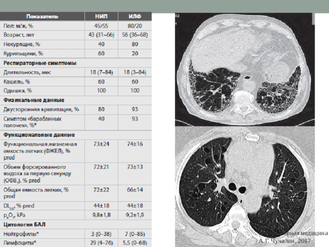 Респираторная медицина А.Г. Чучалин, 2017