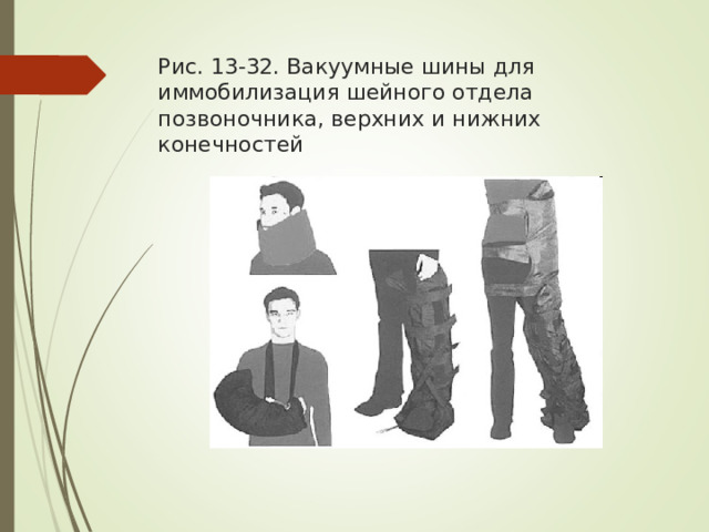 Рис. 13-32. Вакуумные шины для иммобилизация шейного отдела позвоночника, верхних и нижних конечностей