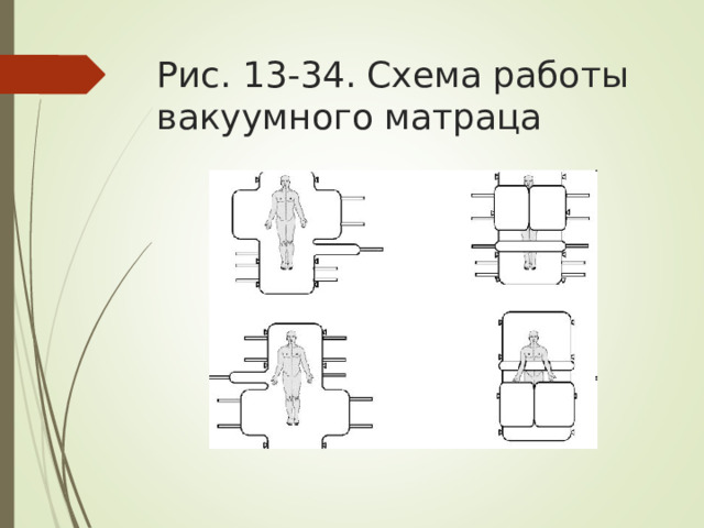 Рис. 13-34. Схема работы вакуумного матраца