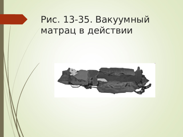 Рис. 13-35. Вакуумный матрац в действии