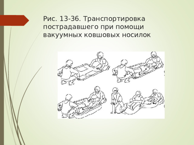 Рис. 13-36. Транспортировка пострадавшего при помощи вакуумных ковшовых носилок