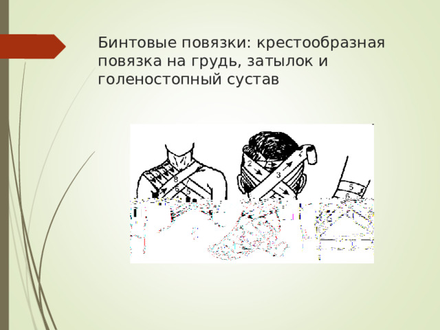 Бинтовые повязки: крестообразная повязка на грудь, затылок и голеностопный сустав