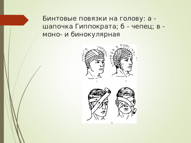 Бинтовые повязки на голову: а - шапочка Гиппократа; б - чепец; в - моно- и бинокулярная