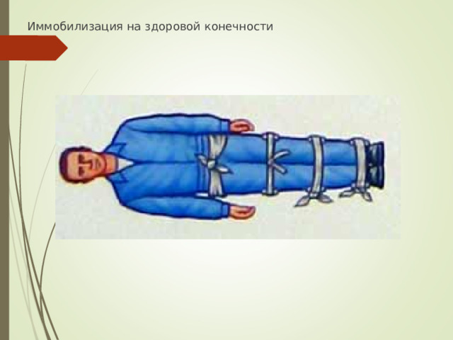 Иммобилизация на здоровой конечности