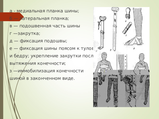 а - медиальная планка шины; б — латеральная планка; в — подошвенная часть шины г —закрутка; д — фиксация подошвы; е — фиксация шины поясом к туловищу и бедру; укрепление закрутки после вытяжения конечности; з —иммобилизация конечности шиной в законченном виде.