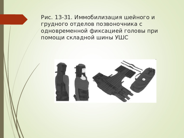 Рис. 13-31. Иммобилизация шейного и грудного отделов позвоночника с одновременной фиксацией головы при помощи складной шины УШС