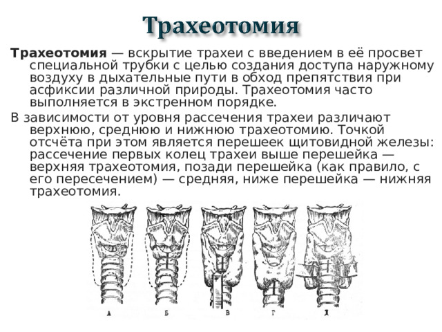 Трахеотомия  — вскрытие трахеи с введением в её просвет специальной трубки с целью создания доступа наружному воздуху в дыхательные пути в обход препятствия при асфиксии различной природы. Трахеотомия часто выполняется в экстренном порядке. В зависимости от уровня рассечения трахеи различают верхнюю, среднюю и нижнюю трахеотомию. Точкой отсчёта при этом является перешеек щитовидной железы: рассечение первых колец трахеи выше перешейка — верхняя трахеотомия, позади перешейка (как правило, с его пересечением) — средняя, ниже перешейка — нижняя трахеотомия.