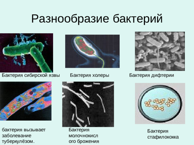 Разнообразие бактерий Бактерия сибирской язвы Бактерия холеры Бактерия дифтерии бактерия вызывает заболевание туберкулёзом. Бактерия молочнокислого брожения Бактерия стафилококка