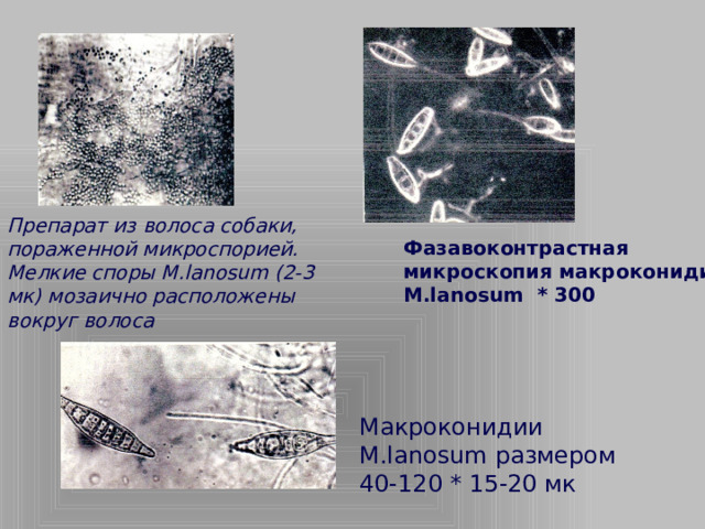 Препарат из волоса собаки, пораженной микроспорией. Мелкие споры M.lanosum (2-3 мк) мозаично расположены вокруг волоса Фазавоконтрастная микроскопия макроконидий M.lanosum * 300 Макроконидии M.lanosum размером 40-120 * 15-20 мк