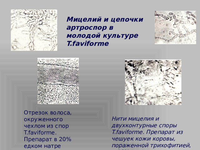 Мицелий и цепочки артроспор в молодой культуре T.faviforme Отрезок волоса, окруженного чехлом из спор T.faviforme. Препарат в 20% едком натре Нити мицелия и двухконтурные споры T.faviforme. Препарат из чешуек кожи коровы, пораженной трихофитией, в 20% едком натре