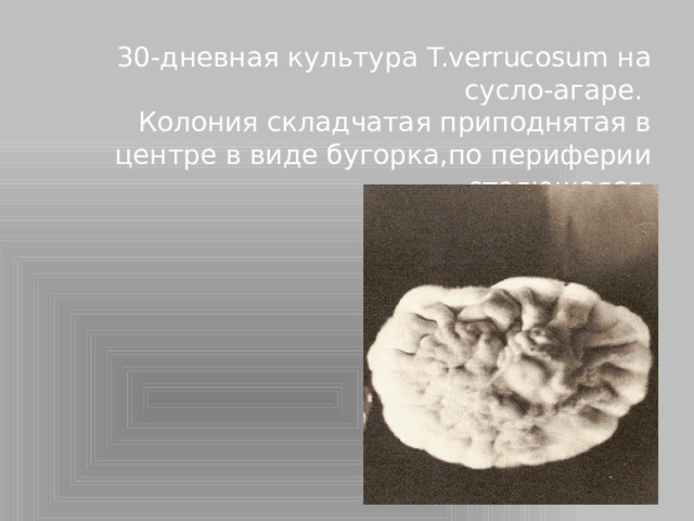 30-дневная культура T.verrucosum на сусло-агаре. Колония складчатая приподнятая в центре в виде бугорка,по периферии стелющаяся.