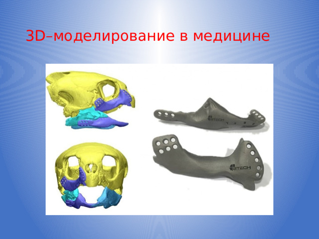 3D–моделирование в медицине