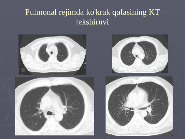 Pulmonal rejimda ko'krak qafasining KT tekshiruvi