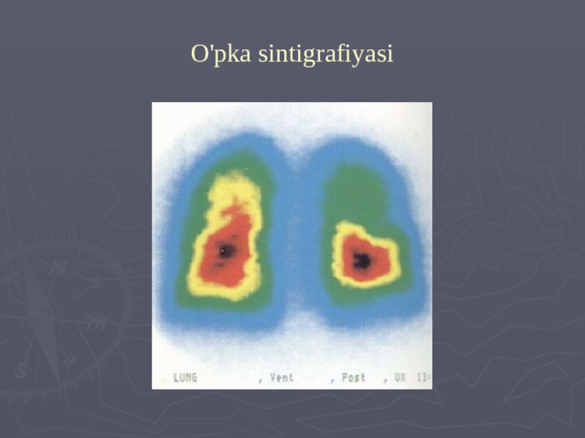 O'pka sintigrafiyasi