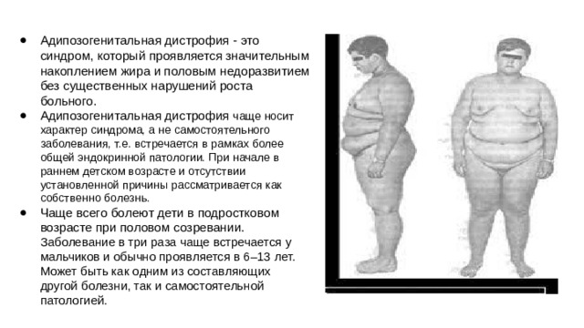 Адипозогенитальная дистрофия - это синдром, который проявляется значительным накоплением жира и половым недоразвитием без существенных нарушений роста больного. Адипозогенитальная дистрофия чаще носит характер синдрома, а не самостоятельного заболевания, т.е. встречается в рамках более общей эндокринной патологии. При начале в раннем детском возрасте и отсутствии установленной причины рассматривается как собственно болезнь. Чаще всего болеют дети в подростковом возрасте при половом созревании.  Заболевание в три раза чаще встречается у мальчиков и обычно проявляется в 6–13 лет. Может быть как одним из составляющих другой болезни, так и самостоятельной патологией.