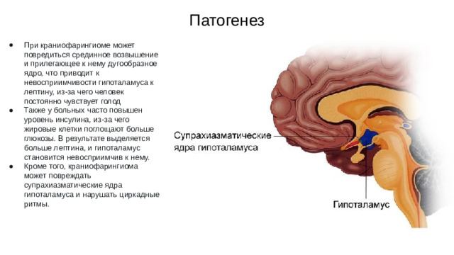 Патогенез