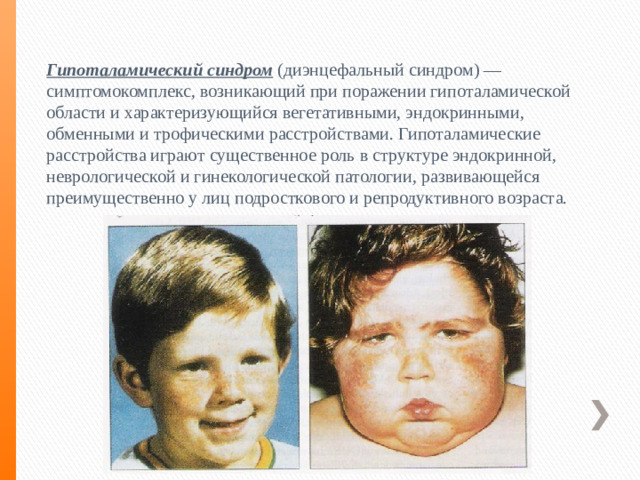 Гипоталамический синдром (диэнцефальный синдром) — симптомокомплекс, возникающий при поражении гипоталамической области и характеризующийся вегетативными, эндокринными, обменными и трофическими расстройствами. Гипоталамические расстройства играют существенное роль в структуре эндокринной, неврологической и гинекологической патологии, развивающейся преимущественно у лиц подросткового и репродуктивного возраста.