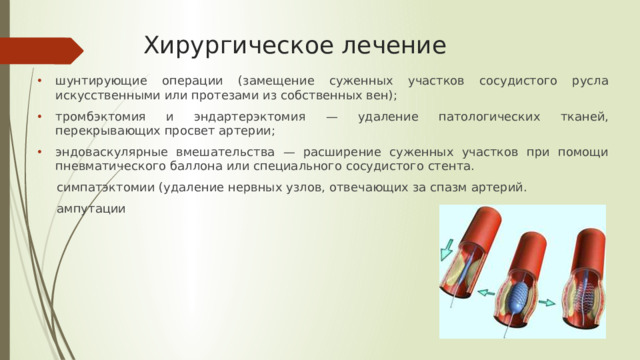 Хирургическое лечение шунтирующие операции (замещение суженных участков сосудистого русла искусственными или протезами из собственных вен); тромбэктомия и эндартерэктомия — удаление патологических тканей, перекрывающих просвет артерии; эндоваскулярные вмешательства — расширение суженных участков при помощи пневматического баллона или специального сосудистого стента.  симпатэктомии (удаление нервных узлов, отвечающих за спазм артерий.  ампутации