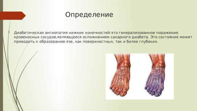 Определение