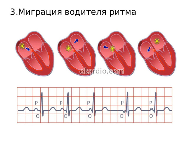 3.Миграция водителя ритма
