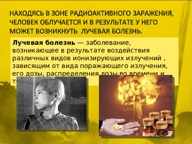 Лучевая болезнь  — заболевание, возникающее в результате воздействия различных видов ионизирующих излучений , зависящим от вида поражающего излучения, его дозы, распределения дозы во времени и теле человека.