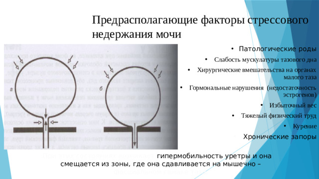 Предрасполагающие факторы стрессового недержания мочи Патологические роды  Слабость мускулатуры тазового дна  Хирургические вмешательства на органах малого таза  Гормональные нарушения (недостаточность эстрогенов)  Избыточный вес  Тяжелый физический труд  Курение  Хронические запоры При этих состояниях возникает гипермобильность уретры и она смещается из зоны, где она сдавливается на мышечно – фасциальном гамаке таза.