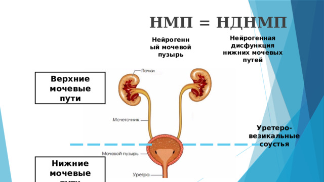 НМП = НДНМП Нейрогенная дисфункция нижних мочевых путей Нейрогенный мочевой пузырь Верхние мочевые пути Уретеро-везикальные соустья Нижние мочевые пути