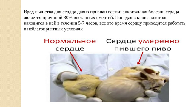 Вред пьянства для сердца давно признан всеми: алкогольная болезнь сердца является причиной 30% внезапных смертей. Попадая в кровь алкоголь находится в ней в течении 5-7 часов, все это время сердцу приходится работать в неблагоприятных условиях