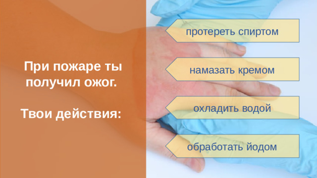 При пожаре ты получил ожог.  Твои действия: протереть спиртом намазать кремом охладить водой обработать йодом