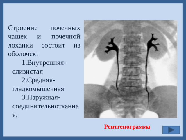 Строение почечных чашек и почечной лоханки состоит из оболочек: Внутренняя- слизистая Средняя- гладкомышечная Наружная- соединительнотканная. Рентгенограмма