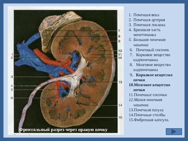 Почечная вена Почечная артерия Почечная лоханка Брюшная часть мочеточника Большая почечная чашечка  6. Почечный сосочек  7. Корковое вещество надпочечника  8. Мозговое вещество надпочечника  9 . Корковое вещество почки Мозговое вещество почки Почечные сосочки Малая почечная чашечка Почечная пазуха Почечные столбы Фиброзная капсула.