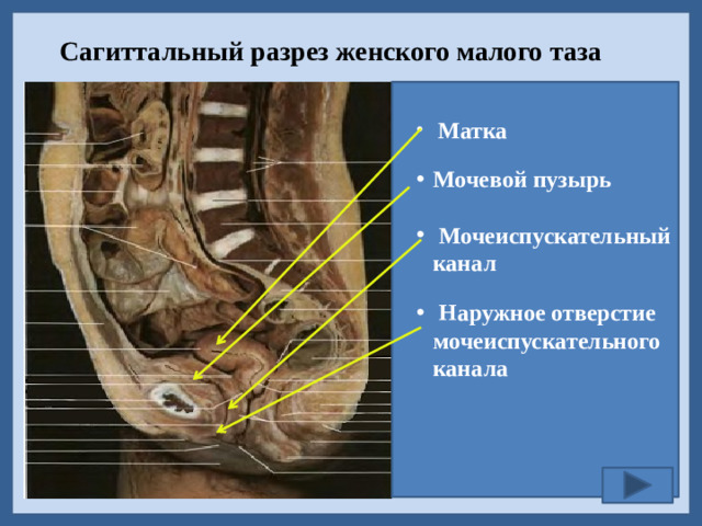 Сагиттальный разрез женского малого таза  Матка Мочевой пузырь