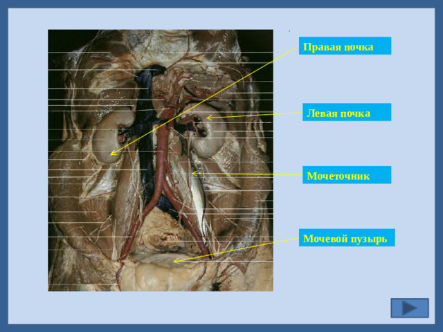 . Правая  почка Левая почка Мочеточник Мочевой пузырь