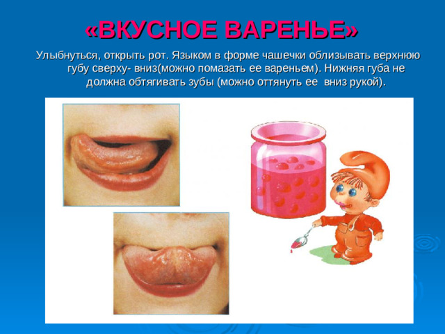 «ВКУСНОЕ ВАРЕНЬЕ» Улыбнуться, открыть рот. Языком в форме чашечки облизывать верхнюю губу сверху- вниз(можно помазать ее вареньем). Нижняя губа не должна обтягивать зубы (можно оттянуть ее вниз рукой).