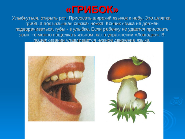 «ГРИБОК»  Улыбнуться, открыть рот. Присосать широкий язычок к небу. Это шляпка гриба, а подъязычная связка- ножка. Кончик языка не должен подворачиваться, губы - в улыбке. Если ребенку не удается присосать язык, то можно пощелкать языком, как в упражнении «Лошадка». В пощелкивании улавливается нужное движение языка.