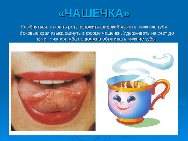 «ЧАШЕЧКА»  Улыбнуться, открыть рот, положить широкий язык на нижнюю губу, боковые края языка загнуть в форме чашечки. Удерживать на счет до пяти. Нижняя губа не должна обтягивать нижние зубы.