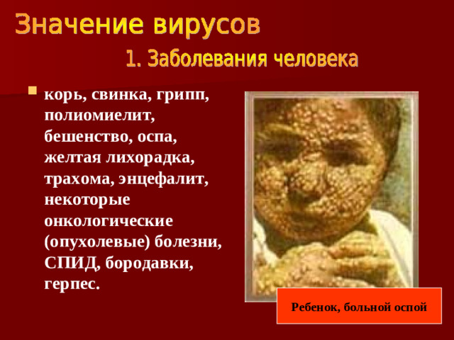 корь, свинка, грипп, полиомиелит, бешенство, оспа, желтая лихорадка, трахома, энцефалит, некоторые онкологические (опухолевые) болезни, СПИД, бородавки, герпес.