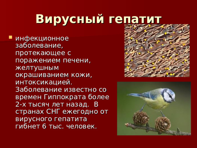 Вирусный гепатит