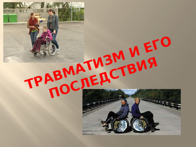 Травматизм и его последствия