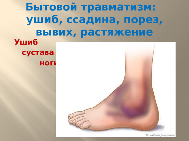 Бытовой травматизм:  ушиб, ссадина, порез, вывих, растяжение Ушиб  сустава  ноги -