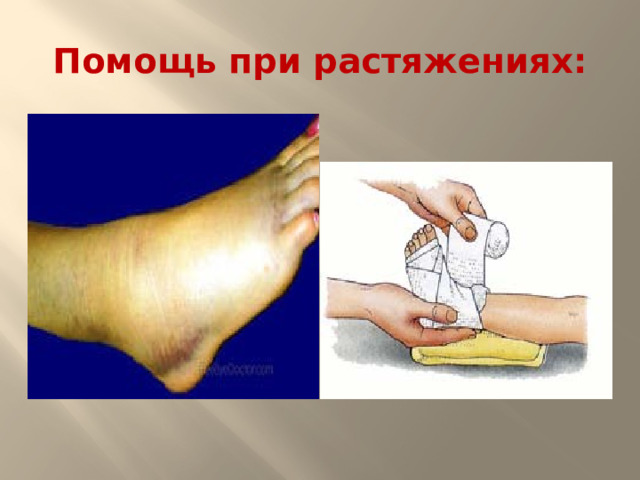 Помощь при растяжениях: