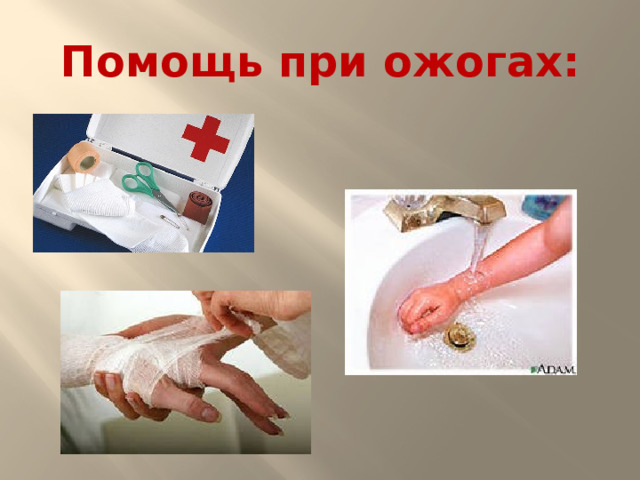 Помощь при ожогах: