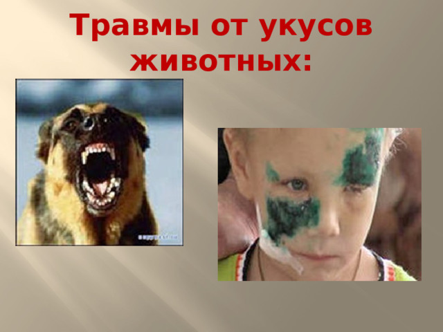 Травмы от укусов животных: