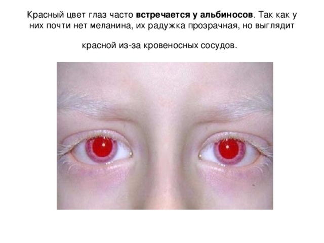 Красный цвет глаз часто встречается у альбиносов . Так как у них почти нет меланина, их радужка прозрачная, но выглядит красной из-за кровеносных сосудов.