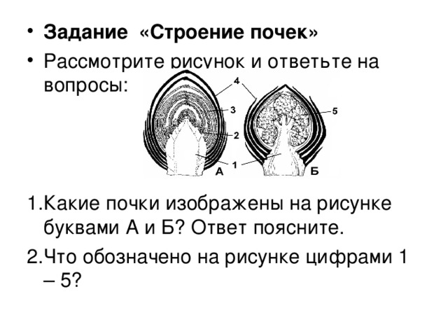 Какая почка изображена на рисунке