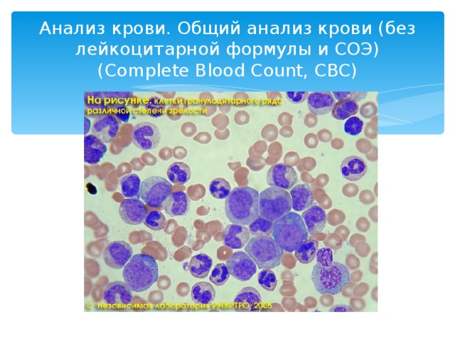 Анализ крови. Общий анализ крови (без лейкоцитарной формулы и СОЭ) (Complete Blood Count, CBC)