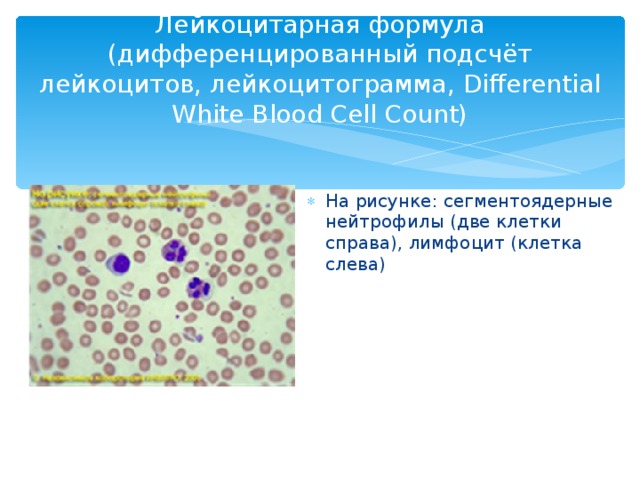 Лейкоцитарная формула (дифференцированный подсчёт лейкоцитов, лейкоцитограмма, Differential White Blood Cell Count)