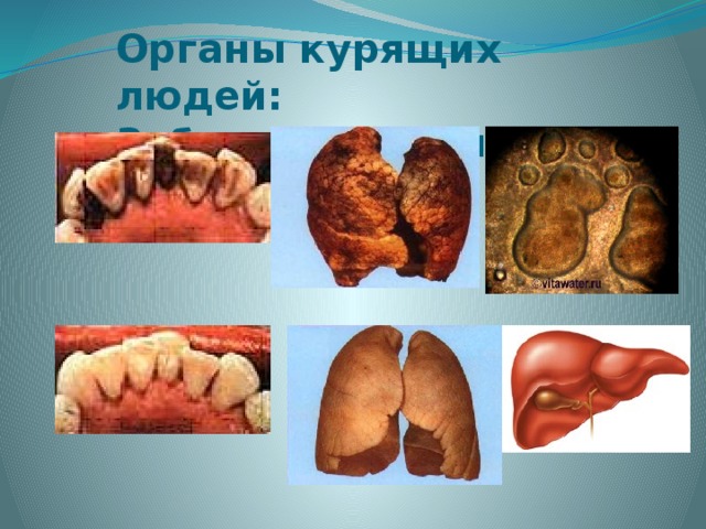 Органы курящих людей: Зубы Лёгкие Печень